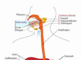 Diverticolite del colon