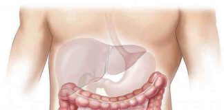 Sintomi morbo di crohn