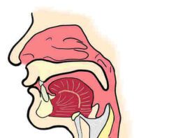 laringoscopia