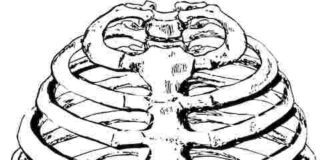 sindrome di tietze