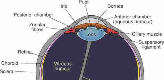 retinoblastoma