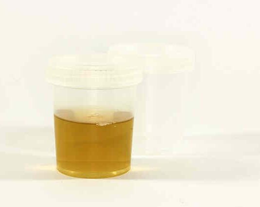 batteriuria nelle urine