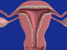 oligomenorrea cause